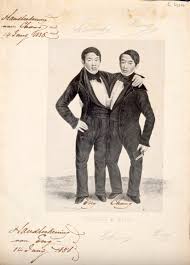 How do conjoined twins masturbatehave sex? : rmorbidquestions
