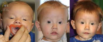 Image result for Blepharis transvaalensis