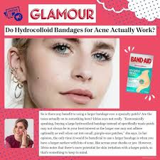 A lot of patients come in complaining about uneven skin texture and "bumps"  all over their face 👩‍⚕️Enlarged sweat glands (aka sebaceous hyperplasia)  are...