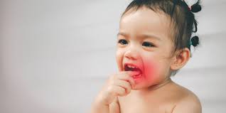 Kinder bekommen während des prozesses des zähnekriegens oft fieber. Zahnprobleme Bei Babys Wenn Zahnen Den Schlaf Raubt