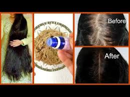 The hair loss blueprint, a hair loss treatment for men and women that actually regrows a full, healthy head of hair, and doesn't cost you an arm and a leg, either. Stop Severe Hair Fall Dandruff Regrow New Hair 100 Works Youtube Hair Mask Anti Hair Fall Severe Hair Fall