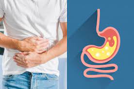 Gastritis merupakan panyakit karena gangguan ? Ini Aneka Penyakit Lambung Yang Mesti Diwaspadai Hindari Penyebabnya Semua Halaman Grid Health