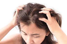 We did not find results for: Ini Bahayanya Kutu Rambut Yang Tidak Segera Dibasmi