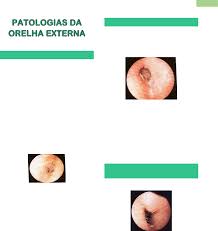Grátis: Otorrinolaringologia - Anatomia da Nasal, Seios paranasais,  Faringe, Laringe e Tuba Auditiva, Patologias da Orelha Externa e Média,  Glândulas salivares, Rinite, Patologias da Laringe, Laringites, Tumo -  Material Claro e Objetivo