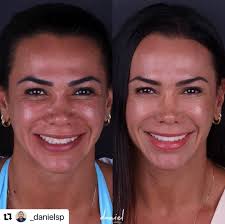 Cesar Sakakura (@cesarsakakura) • Instagram-foto's en -video's