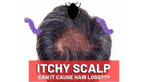 Hair loss can appear in many different ways, depending on what's causing it. Itchy Scalp Hair Loss Causes And Treatments Hairguard