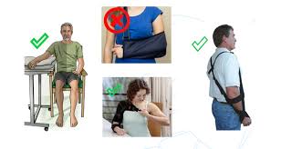 Image result for Shoulder Subluxation