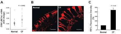 Chapter 20 june 17, 2021 chapter 19 june 12, 2021 @2020 mangaforfree.net. Ijms Free Full Text Ire1a Is A Therapeutic Target For Cystic Fibrosis Airway Inflammation Html