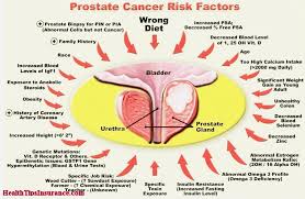 Prostate cancer treatment can include active surveillance, surgery, radiation therapy, hormonal therapy, chemotherapy, immunotherapy, and supportive care. Best Prostate Cancer Quotes Quotesgram