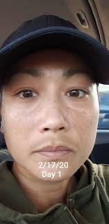 Maybe you would like to learn more about one of these? The Spot Cream Reviews Musely Facerx Prescription Skincare