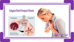 27 Gangguan Pada Sistem Pernapasan Manusia Gejala Dan Pencegahannya Lengkap Ilmu Pengetahuan Alam Ipa