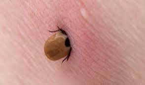 Mar 16, 2017 · truth: High Number Of Tick Bites Expected This Summer Rivm