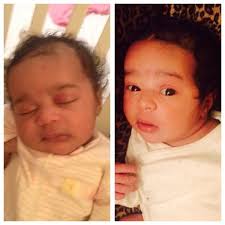 When your new born baby who at the time of birth sported a head full of hair suddenly starts to experience hair loss, hair thinning or even complete fall out of hair, then you as a mother are bound to freak out. Newborn Hair Loss Poll Included Babycenter
