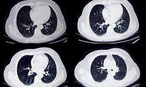 Medically reviewed by seunggu han, m.d. Ai System Detects Cancer Tumours Missed By Conventional Diagnostics