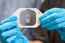 Image result for Sweat Chloride