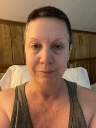 For the first time ,when I want to my dentist appointment. My dentist ask  about my nf. And he look it up to make sure i was able to be but under.