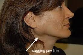 Parotidectomy Reconstruction Facial Surgery Reconstructive Surgery Is An Option That M Facial Surgery Plastic And Reconstructive Surgery Reconstructive Surgery