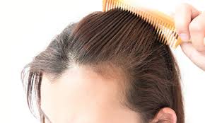 Too much of this vitamin can cause hair loss. Exclusively For Women Thinning Hair Treatment