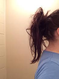 A buildup of fat between the shoulder blades causes a hump in the back of the neck to form. How To Get Rid Of Hump Back Vtwctr
