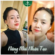 Khuôn mặt có đường cong, đường thẳng, nhưng Charming thấy cái đường sóng  mũi là cái