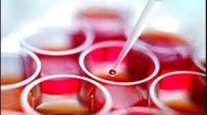 In anul 2016, in sectia de hematologie a institutului oncologic „prof. Institutul Oncologic Cluj Napoca Cea Mai NouÄ ClincÄ De Hematologie Din ÈarÄ