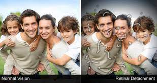 Maybe you would like to learn more about one of these? Retinal Detachment Eye Physicians Surgeons Billings Mt