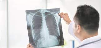 Sie ist durch entzündete und dauerhaft verengte atemwege gekennzeichnet. Wie Gut Ist Eine Leichte Copd Im Rontgen Thorax Erkennbar