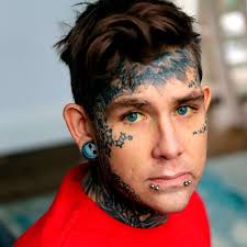 Huddersfield barman told to take laxatives after his stomach balloons