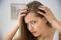 La perte de cheveux s'étend ensuite au vertex correspondant au haut du crâne jusqu'à un aspect de tonsure quand il ne reste plus que des cheveux sur les côtés et l'arrière. Chute De Cheveux Alopecie Cause Que Faire Qui Consulter