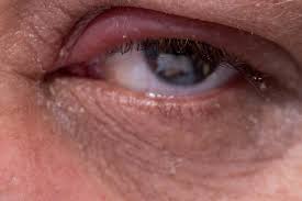 Image result for Blepharis bainesii