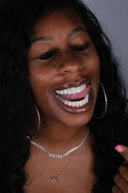 Hey guys Did anybody recently have done extraction of the wisdom tooth ?  How much one teeth costed you ?