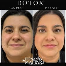 𝙁𝙚𝙧𝙣𝙖𝙣𝙙𝙖 𝙈𝙖𝙩𝙩𝙖𝙧 𝘿𝙚 𝙇𝙖́ 𝙎𝙖́𝙫𝙞𝙖  (@dra.fernandamattardelasavia) • Instagram photos and videos