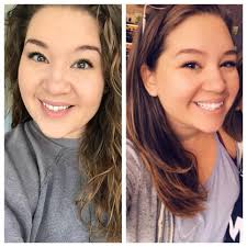 Has keto diet reduced mucus production and allergy symptoms?