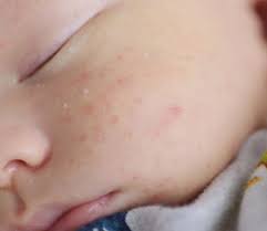 Schwanger Nach Kaiserschnitt Wie Lange Soll Ich Warten Echte Mamas