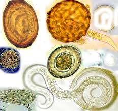 Image result for Helminth