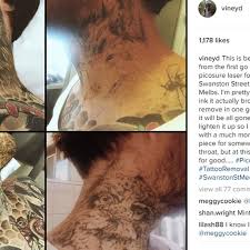 Jun 14, 2021 · britney spears posed in a backless swimsuit while showing off her favorite tattoo, a design on the back of her neck which she said means healing in hebrew. The Block S Dale Vine Launches Laser Mission To Ditch Neck Tattoo