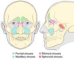 Sinus Infection Remedies And Why You Might Not Need Antibiotics Sinus Infection Remedies Sinusitis Paranasal Sinuses