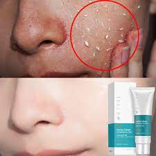 Please wear sunscreen every day, at least for a month or so after the facial peel. 100ml Deep Cleansing Exfoliating Peeling Gel Moisturizes Face Exfoliating Cream Soft Organic Facial Cream Facial Scrub Cleaner Aliexpress