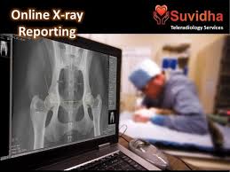 Xray filter photo scans bonuses, promo codes, awards and other ways to get an advantage. Online X Ray Reporting For Telereporting Suvidha Healthcare Private Limited Id 23602548133