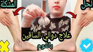 Maybe you would like to learn more about one of these? ÙƒÙ†Ø² Ø¬Ø¹Ù„Ù‡ Ø§Ù„Ù„Ù‡ Ø¹Ù„Ø§Ø¬ Ø¯ÙˆØ§Ù„ÙŠ Ø§Ù„Ø³Ø§Ù‚ÙŠÙ† ÙˆÙŠØ´ÙÙŠ Ø¨Ø³Ø±Ø¹Ø© Ø·Ø±Ù‚ Ø·Ø¨ÙŠØ¹ÙŠØ© Ù„Ù…Ø­Ø§Ø±Ø¨Ø© Ø§Ù„Ø£ÙˆØ±Ø¯Ø© Ø§Ù„Ø¹Ù†ÙƒØ¨ÙˆØªÙŠØ© ÙˆØ¯ÙˆØ§Ù„ÙŠ Ø§Ù„Ø³Ø§Ù‚ÙŠÙ† Youtube