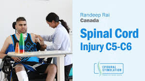 Canadian C5 C6 Spinal Cord Injury Patient Randeep S Road To Recovery After Epidural Stimulation Youtube