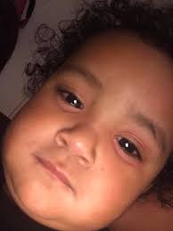 Cochrane urgent care eye doctor availability?