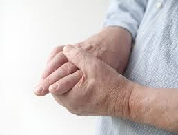 There are numerous symptoms and signs associated with degenerative arthritis 