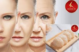 Tác Dụng Của Yến Chưng là gì? Mẹo Chưng Yến Ngon?