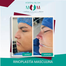 Milton Marquez Master en Cirugia Estética