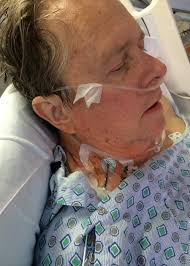 Georgia writer's battle with the superbug C. diff