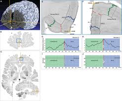 Lim chize yong is on facebook. Bigbrain An Ultrahigh Resolution 3d Human Brain Model Science