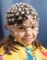 Medicaid Funded Services for Individuals with an Autism Spectrum Diagnosis