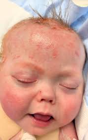 Amaya's NICU Journey and Upcoming Washout Procedure