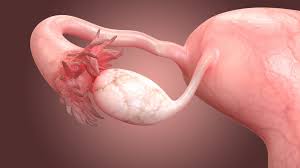 The internal reproductive organs include: What Are The Common Causes Of Ovary Pain Complete Women Care